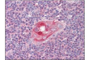Human Thymus (formalin-fixed, paraffin-embedded) stained with RGS1followed by biotinylated anti-goat IgG secondary antibody, alkaline phosphatase-streptavidin and chromogen. (RGS1 Antikörper  (C-Term))