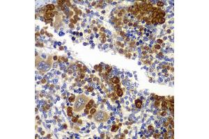 Immunohistochemistry of paraffin-embedded rat spleen using PRKAB1 antibody (ABIN5995401) at dilution of 1/100 (40x lens). (PRKAB1 Antikörper)