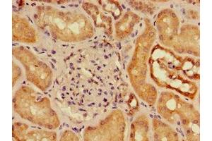 Immunohistochemistry (IHC) image for anti-Solute Carrier Family 16, Member 9 (Monocarboxylic Acid Transporter 9) (SLC16A9) (AA 185-304) antibody (ABIN7160177)