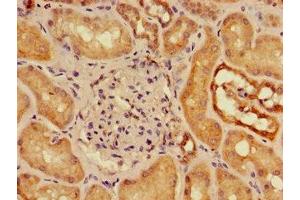 Immunohistochemistry of paraffin-embedded human kidney tissue using ABIN7160177 at dilution of 1:100 (SLC16A9 Antikörper  (AA 185-304))