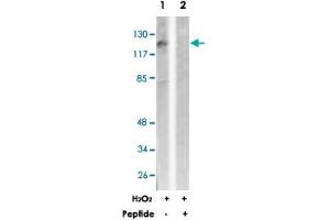 Western blot analysis of extracts from LoVo cells, treated with H 2 O 2  (100 uM, 30 mins), using PDGFRB polyclonal antibody . (PDGFRB Antikörper)