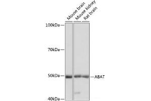 Western blot analysis of extracts of various cell lines using ABAT Polyclonal Antibody at dilution of 1:1000. (ABAT Antikörper)