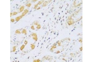 Immunohistochemistry of paraffin-embedded Human stomach using FDXR Polyclonal Antibody at dilution of 1:100 (40x lens). (Ferredoxin Reductase Antikörper)