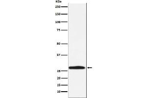Western blot analysis of Carbonic Anhydrase 1 expression in K562 cell lysate.
