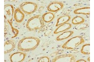 Immunohistochemistry of paraffin-embedded human kidney tissue using ABIN7171975 at dilution of 1:100 (TPK1 Antikörper  (AA 1-243))
