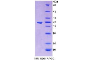 SDS-PAGE (SDS) image for Core-Binding Factor, beta Subunit (CBFB) (AA 1-182) protein (His tag) (ABIN6238642)