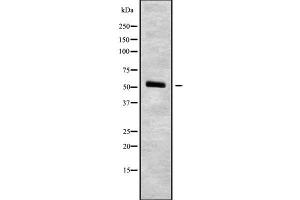 Western blot analysis of DCTN4 using COLO205 whole cell lysates (Dynactin 4 Antikörper  (Internal Region))