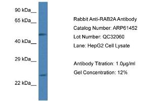 Western Blotting (WB) image for anti-RAB2A, Member RAS Oncogene Family (RAB2A) (C-Term) antibody (ABIN2788809) (RAB2A Antikörper  (C-Term))