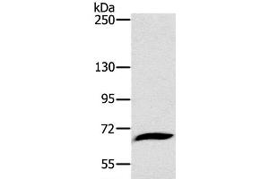 Western Blot analysis of Mouse liver tissue using CD42b Polyclonal Antibody at dilution of 1:800 (CD42b Antikörper)