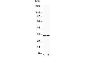 Western blot testing of Bcl2A1 antibody and (1) HeLa, (2) Jurkat lysate (BCL2A1 Antikörper  (N-Term))