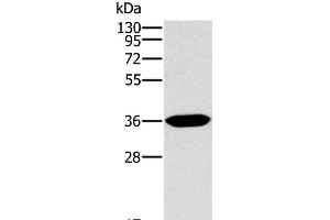 Western Blot analysis of Human fetal intestine tissue using ITLN1 Polyclonal Antibody at dilution of 1:400 (ITLN1/Omentin Antikörper)