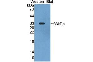 Western blot analysis of the recombinant protein. (GLMN Antikörper  (AA 294-549))