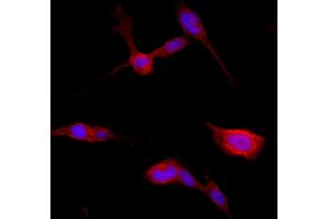 Confocal immunofluorescence - anti-Catenin beta1 Ab in BEAS-2B cells at 1/250 dilution, cells were fixed with 4% of PFA, (beta Catenin Antikörper  (C-Term))