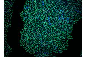 Immunoflourescent staining of Sox2 in human embryonic stem (ES) cells. (SOX2 Antikörper)