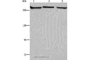 Western blot analysis of PC3, NIH/3T3 and HUVEB cell, using FLNA Polyclonal Antibody at dilution of 1:1100 (Filamin A Antikörper)