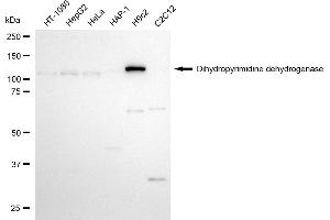 Western blotting analysis using dihydropyrimidine dehydrogenase antibody (ABIN7798341).
