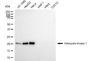 Western blotting analysis using Adenylate kinase 1 antibody (ABIN7797519). (Adenylate Kinase 1 Antikörper)