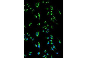 Immunofluorescence analysis of MCF-7 cells using APOBEC3G antibody. (APOBEC3G Antikörper)