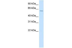 WB Suggested Anti-HOXD3 Antibody Titration:  0.