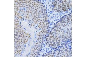 Immunohistochemistry of paraffin-embedded mouse testis using MCM4 Antibody (ABIN5971548) at dilution of 1/100 (40x lens). (MCM4 Antikörper)