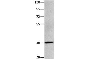 Western Blot analysis of Human brain glioma tissue using MAGEB4 Polyclonal Antibody at dilution of 1:550 (MAGEB4 Antikörper)