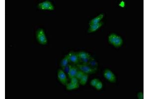 Immunofluorescent analysis of HepG2 cells using ABIN7143372 at dilution of 1:100 and Alexa Fluor 488-congugated AffiniPure Goat Anti-Rabbit IgG(H+L) (GPR124 Antikörper  (AA 1069-1338))