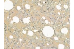 ABIN6261668 and ABIN6276496 at 1/100 staining human normal lung tissue by IHC-P.