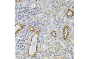 Immunohistochemistry of paraffin-embedded rat kidney using KRT20 Antibody. (KRT20 Antikörper  (AA 245-424))