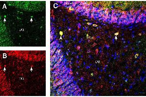 Protein Interacting With Protein Kinase C, alpha 1 (PICK1) peptide