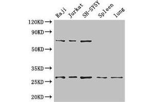 Western Blot Positive WB detected in: Raji whole cell lysate, Jurkat whole cell lysate, SH-SY5Y whole cell lysate, Mouse spleen tissue, Mouse lung tissue All lanes: YWHAZ antibody at 3.
