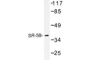 Image no. 1 for anti-5-Hydroxytryptamine (serotonin) Receptor 5B (HTR5B) antibody (ABIN317728) (HTR5B Antikörper)