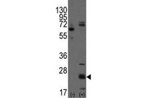 Western blot analysis of CD9 antibody and 293 cell lysate (2 ug/lane) either nontransfected (Lane 1) or transiently transfected with the CD9 gene (2). (CD9 Antikörper  (AA 21-51))