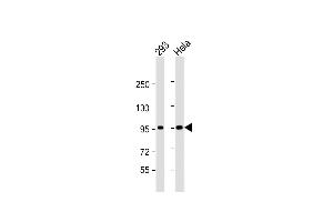 All lanes : Anti-CTNNB1 Antibody (C-term) at 1:1000 dilution Lane 1: 293 whole cell lysate Lane 2: Hela whole cell lysate Lysates/proteins at 20 μg per lane. (CTNNB1 Antikörper  (C-Term))