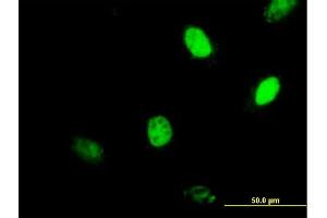Immunofluorescence of purified MaxPab antibody to MGMT on HeLa cell. (MGMT Antikörper  (AA 1-207))