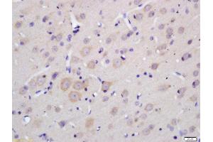 Formalin-fixed and paraffin embedded rat brain labeled with Anti-MOBP Polyclonal Antibody, Unconjugated  at 1:200 followed by conjugation to the secondary antibody and DAB staining.