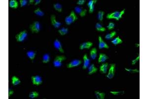 Immunofluorescence staining of Hela cells with ABIN7143811 at 1:133, counter-stained with DAPI. (ACTN1 Antikörper  (AA 1-204))
