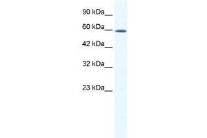 WB Suggested Anti-DDX5  Antibody Titration: 1. (DDX5 Antikörper  (C-Term))