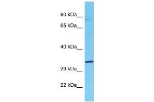 Host:  Rabbit  Target Name:  OS9  Sample Type:  Lung Tumor lysates  Antibody Dilution:  1. (OS9 Antikörper  (C-Term))