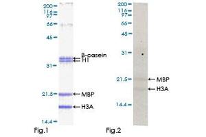 Kinase Activity Assay (KAA) image for Testis-Specific serine Kinase 2 (TSSK2) (AA 1-358) protein (GST tag) (ABIN1323977) (TSSK2 Protein (AA 1-358) (GST tag))
