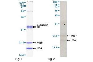 Kinase Activity Assay (KAA) image for Testis-Specific serine Kinase 2 (TSSK2) (AA 1-358) protein (GST tag) (ABIN1323977) (TSSK2 Protein (AA 1-358) (GST tag))