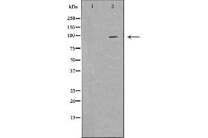 Western blot analysis of 293T whole cell lysates, using EPB41 Antibody. (EPB41 Antikörper  (Internal Region))