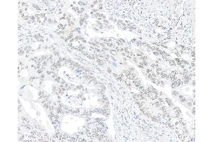 anti-Nucleoprotein TPR (TPR) (C-Term) antibody