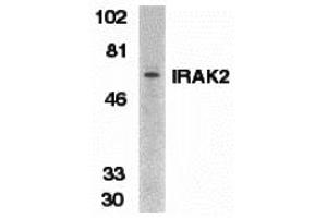 Western Blotting (WB) image for anti-Interleukin-1 Receptor-Associated Kinase 2 (IRAK2) (C-Term) antibody (ABIN1030444)