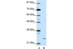 Western Blotting (WB) image for anti-Zinc Finger Protein 253 (ZNF253) antibody (ABIN2461909) (ZNF253 Antikörper)
