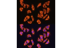 Immunofluorescence analysis of U2OS cells using alpha Sarcoglycan (alpha Sarcoglycan (SGCA)) Rabbit pAb (ABIN1682687, ABIN5664644, ABIN5664646 and ABIN6220497) at dilution of 1:100. (SGCA Antikörper  (AA 60-290))