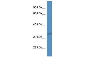 Western Blot showing Bend6 antibody used at a concentration of 1. (BEND6 Antikörper  (C-Term))