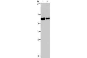 Gel: 6 % SDS-PAGE, Lysate: 40 μg, Lane 1-2: Hela cells, A172 cells, Primary antibody: ABIN7191819(PDE4A Antibody) at dilution 1/300, Secondary antibody: Goat anti rabbit IgG at 1/8000 dilution, Exposure time: 20 seconds (PDE4A Antikörper)