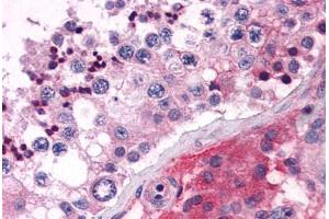 Anti-ELOVL5 antibody  ABIN1048538 IHC staining of human testis. (ELOVL5 Antikörper  (C-Term))