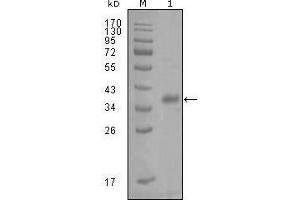 Western blot analysis using FABP4 mouse mAb against truncated Trx-FABP4 recombinant protein (1). (FABP4 Antikörper  (AA 61-121))