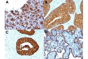 Immunohistochemical staining (Formalin-fixed paraffin-embedded sections) of human pancreas (A), human colon carcinoma (B), human cervical carcinoma (C) and human placenta (D) with MAML3 monoclonal antibody, clone MAML3/1303 . (MAML3 Antikörper)